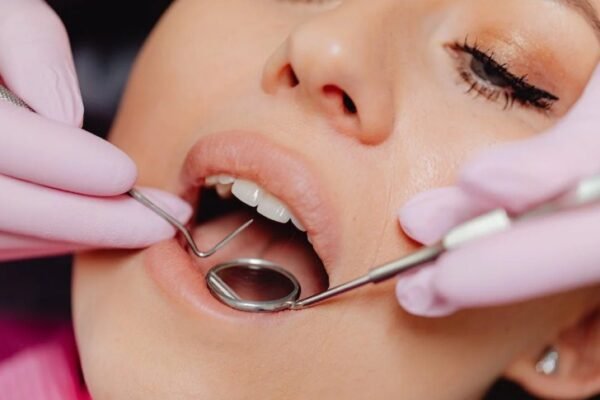 Dental Insurance