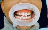 Importance of Oral Health