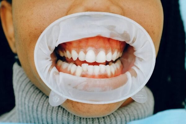 Importance of Oral Health