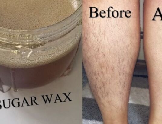 Sugaring Before and After