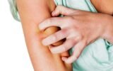 Can Detoxing Make You Itch