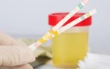 Can You Take a Urine Drug Test on Your Period