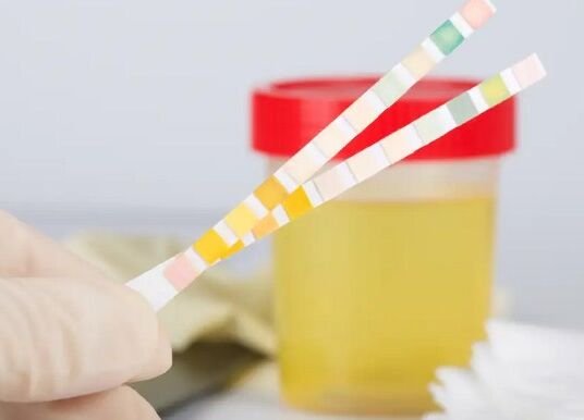 Can You Take a Urine Drug Test on Your Period