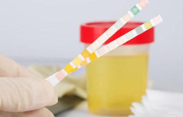 Can You Take a Urine Drug Test on Your Period
