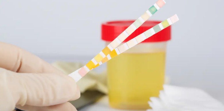 Can You Take a Urine Drug Test on Your Period