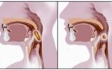 How to Swallow Properly for Mewing