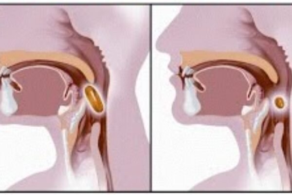 How to Swallow Properly for Mewing