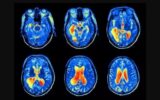 Radiologist vs Neurologist