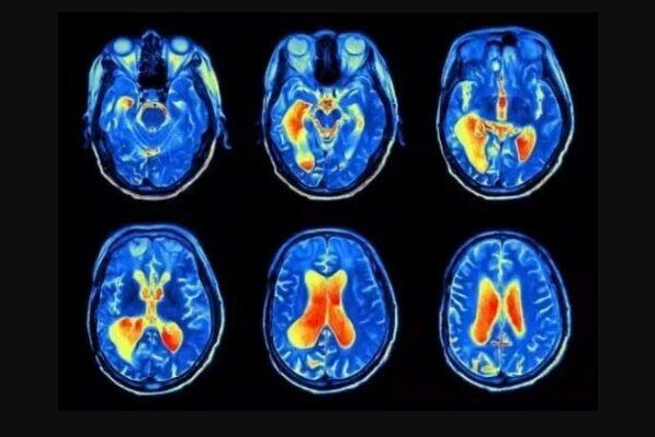 Radiologist vs Neurologist