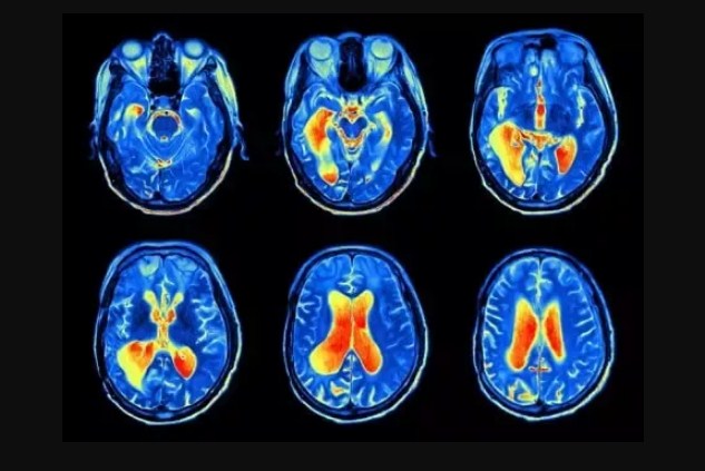 Radiologist vs Neurologist