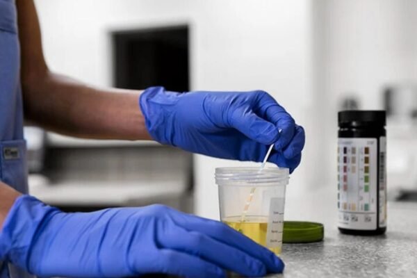 How Long After Being Drugged Can You Get Tested