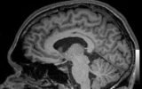 How to Repair White Matter in the Brain