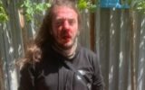 civil activist zuka berdzenishvili attacked