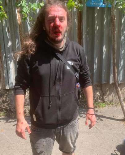 civil activist zuka berdzenishvili attacked