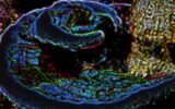 Georgia Tech researchers immune organoids