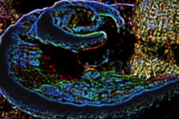 Georgia Tech researchers immune organoids