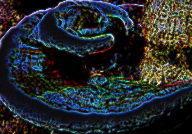 Georgia Tech researchers immune organoids