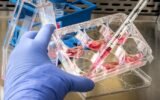 Disease outbreak Congo WHO response