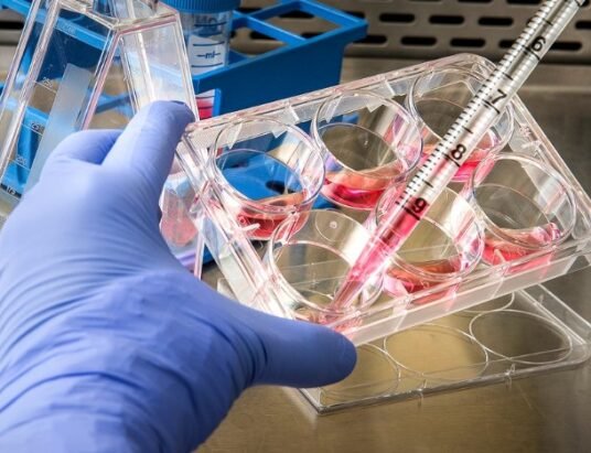 Disease outbreak Congo WHO response