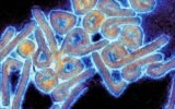Marburg virus electron microscope image