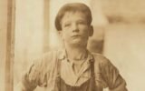 12-year-old Georgia boy burn unit Augusta