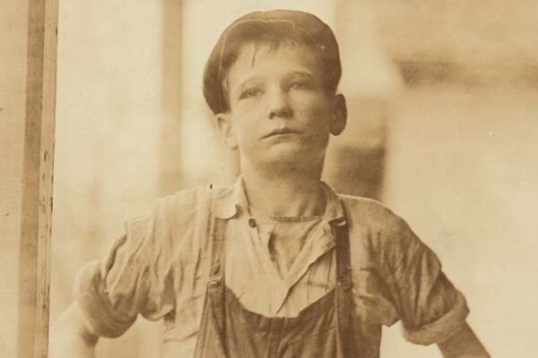 12-year-old Georgia boy burn unit Augusta