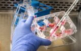 Human Metapneumovirus cases India