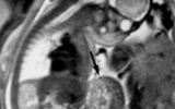 pregnancy brain changes MRI scan