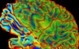brain health research