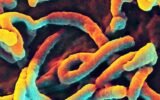Ebola virus electron