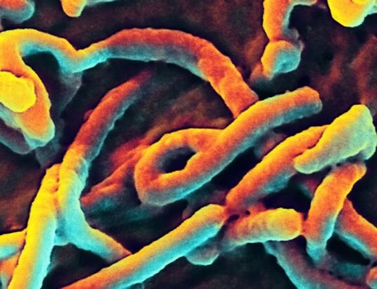 Ebola virus electron