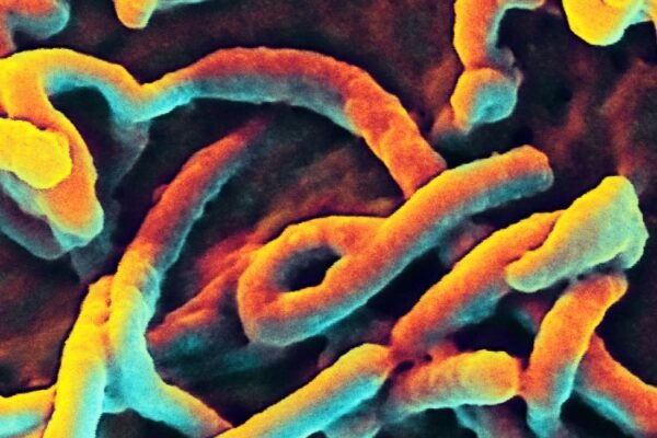 Ebola virus electron