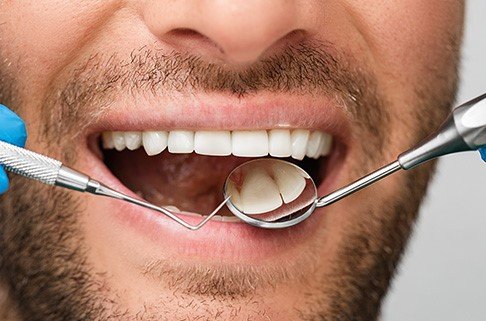 European Federation of Periodontology oral health
