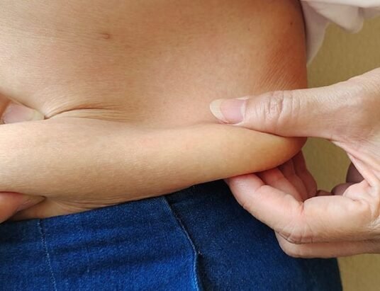 fatty liver disease treatment