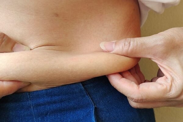 fatty liver disease treatment