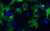 human coronavirus HKU1