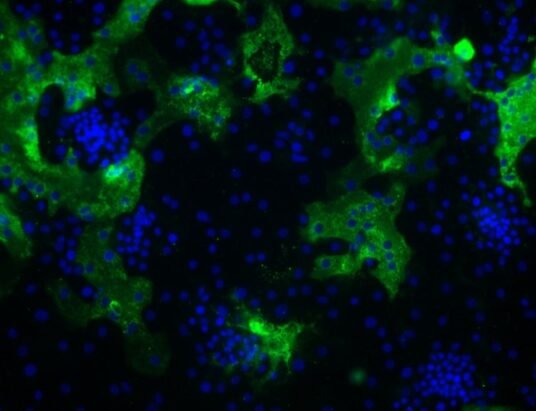 human coronavirus HKU1