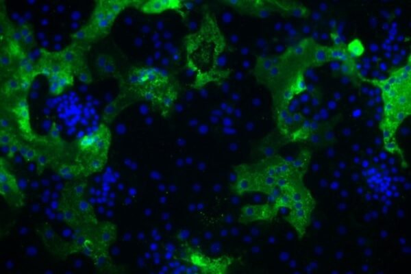 human coronavirus HKU1