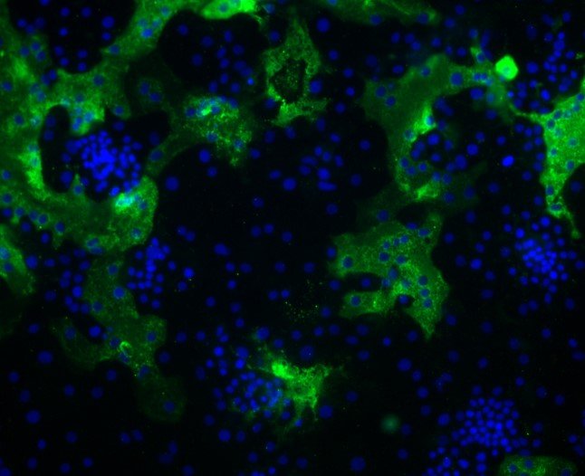 human coronavirus HKU1