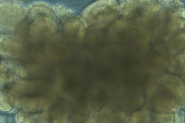 Oregon prion disease
