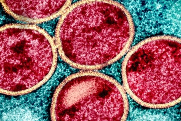 mpox virus under microscope close up