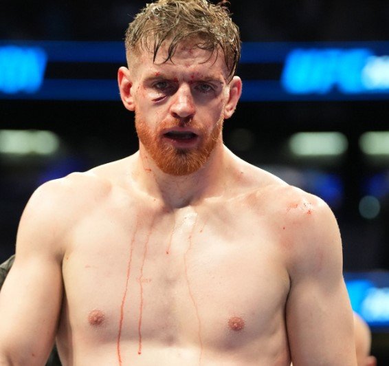 Edmen Shahbazyan UFC fight