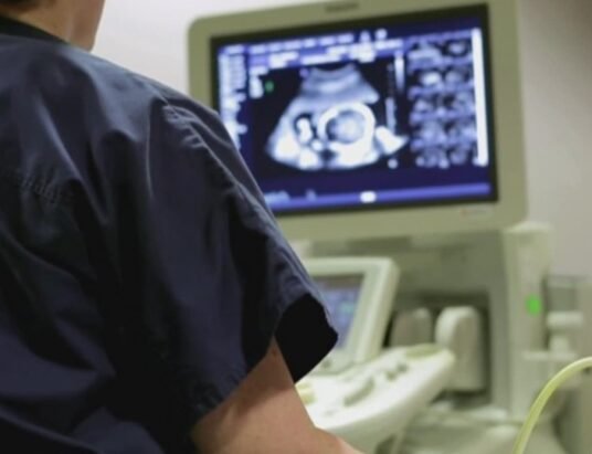 brain-dead pregnant woman abortion law protest georgia