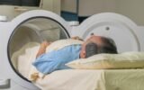 Bryan Johnson hyperbaric oxygen therapy chamber