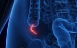 appendix-cancer-rise-us