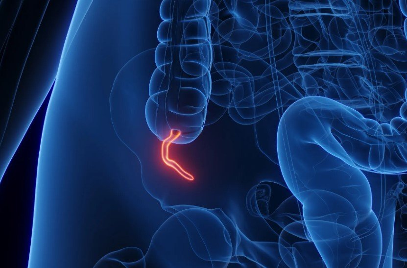 appendix-cancer-rise-us