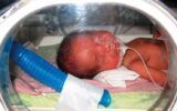 premature baby in neonatal intensive care unit