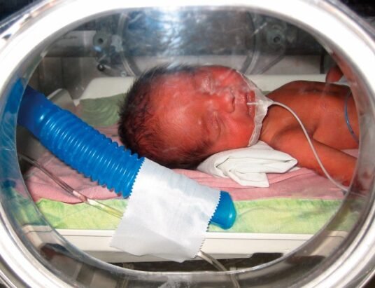 premature baby in neonatal intensive care unit
