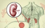 pig lung transplant