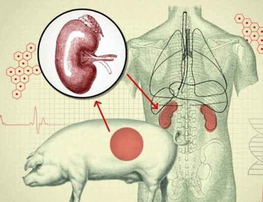 pig lung transplant